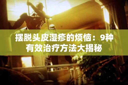 摆脱头皮湿疹的烦恼：9种有效治疗方法大揭秘
